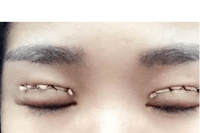 聚焦医疗美容乱象温州通报八起非法医疗美容案例(图3)