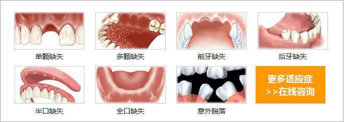 又一个暴利行业被揭成本几百元装一颗要上万元