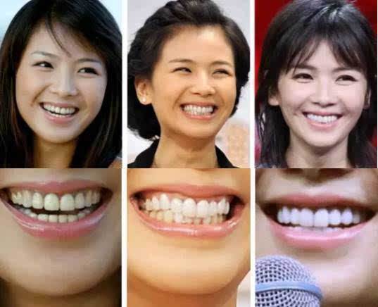 每天都用心刷牙为何牙齿还是微黄色？明星是怎么做到一口白牙？(图3)