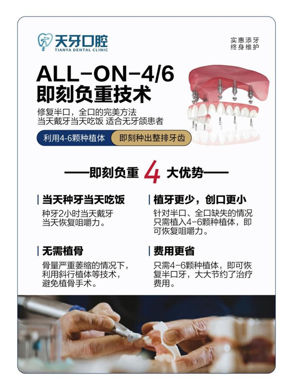 在乌鲁木齐做即刻种植牙要多少钱？天牙口腔(图2)