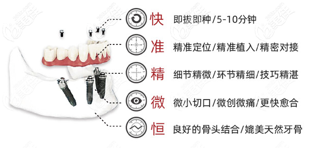 种植牙手术有几种方式？哪种技术更先进速度更快？(图2)