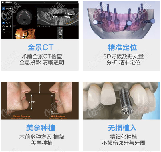 种植牙手术有几种方式？哪种技术更先进速度更快？(图3)