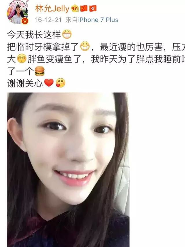宝威体育下载网站：宝威体育官网：刘涛花了300万重做牙齿一颗牙4万美容效果就像换了一个头(图1)