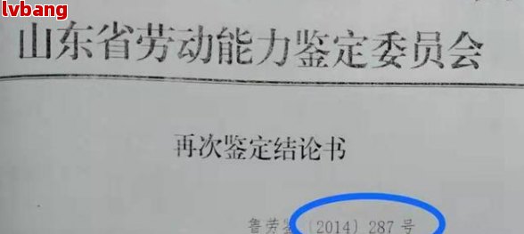 牙齿工伤赔偿标准2023最新版及赔偿方式(图4)