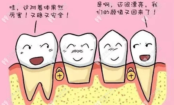 宝威体育下载网站：宝威体育官网：：3d数字化微创种植牙和传统种植牙技术的区别种牙须知(图4)