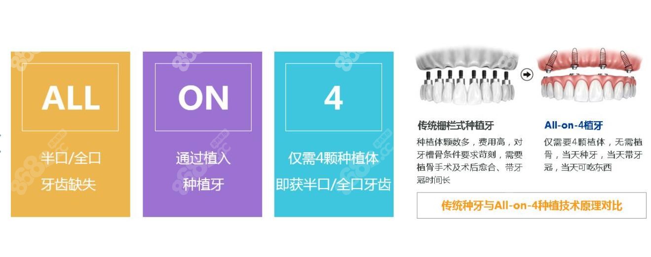 目前先进的全口种植牙技术就有穿颧穿翼、ALL-ON-46等(图3)