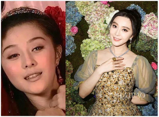 整牙是变美还是变残明星集体整牙为哪般？(图11)