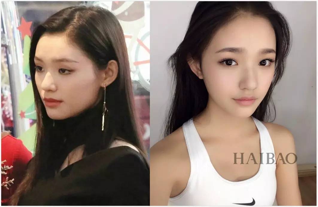 宝威体育：整牙是变美还是变残明星集体整牙为哪般？(图3)