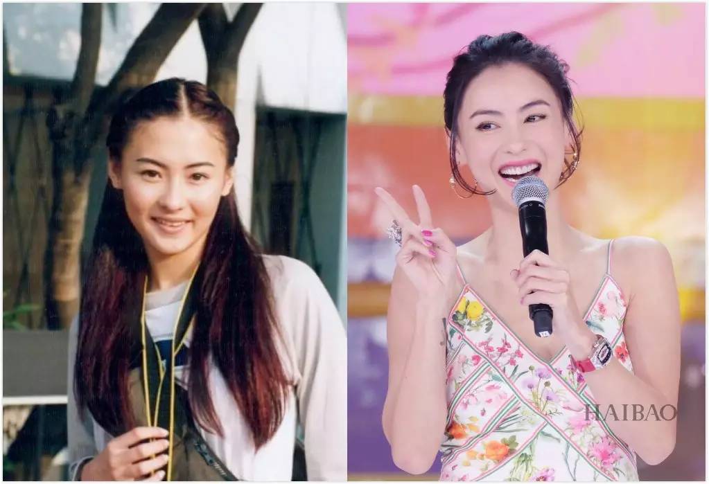 整牙是变美还是变残明星集体整牙为哪般？(图16)