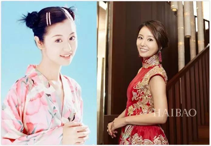 整牙是变美还是变残明星集体整牙为哪般？(图18)