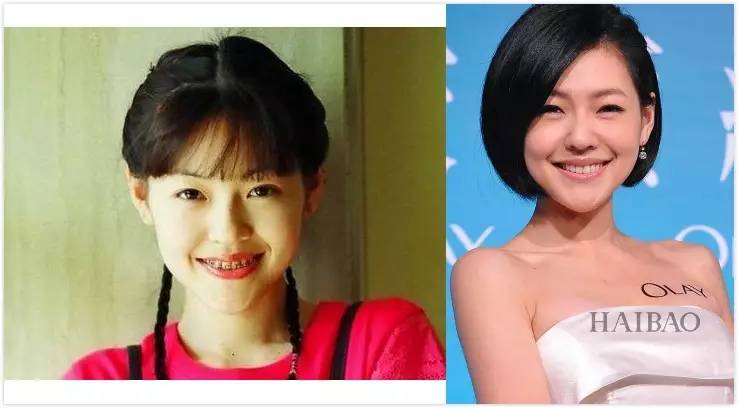 宝威体育：整牙是变美还是变残明星集体整牙为哪般？(图19)