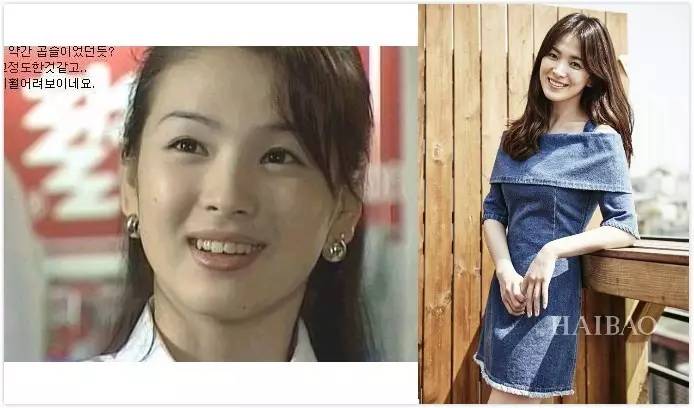 宝威体育：整牙是变美还是变残明星集体整牙为哪般？(图21)