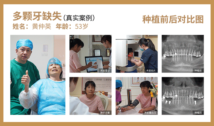 “看牙10年我花了几十万” 学会这个办法帮你省下90%的钱！(图9)
