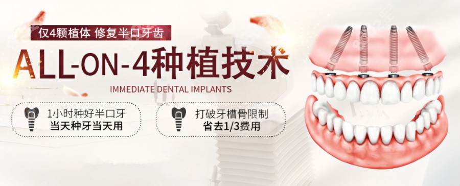 宝威体育下载网站：宝威体育官网：宝威体育：TOP3排名：在南京种一颗牙多少钱_种牙材料国产和进口区别