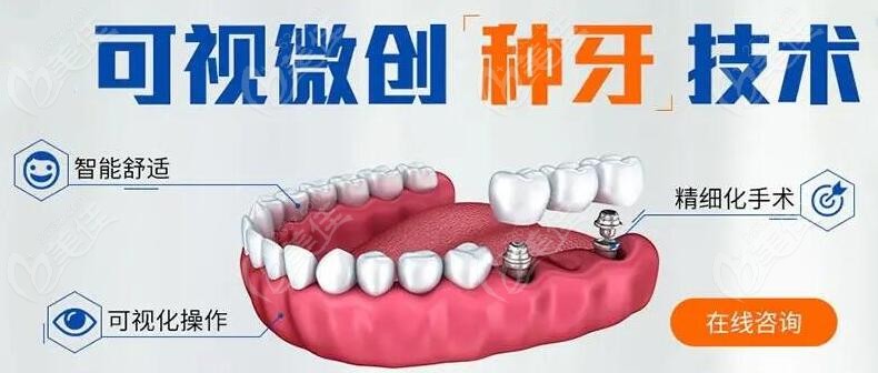 缺牙时间长？想省钱？快来免费种牙了！