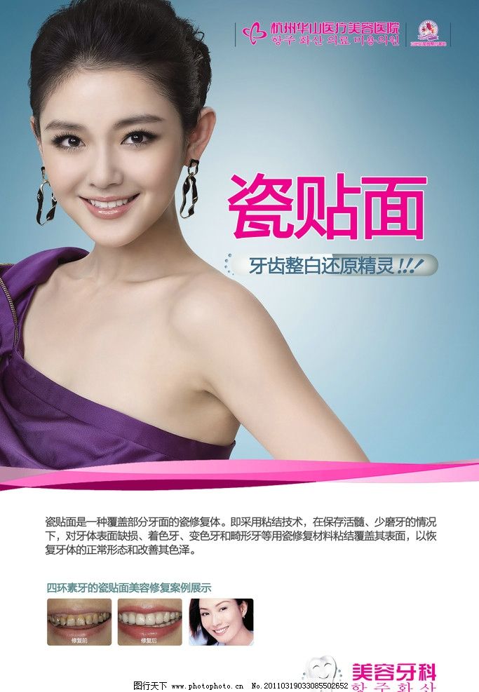 怎么做牙齿美容