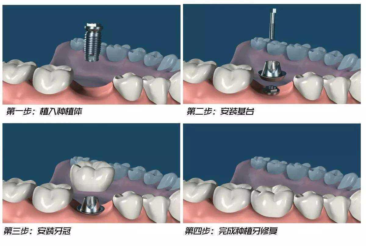宝威体育官网：宝威体育下载网站：权威健康科普内容平台-彩牛养生