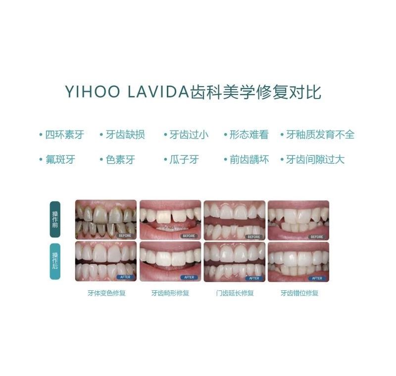 宝威体育官网：9月2日LAVIDA修复中心发布最新牙齿修复技术视频(图3)