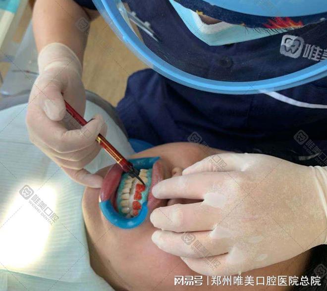 宝威体育官网：郑州补牙二七广场那个医院好(图2)